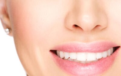 Porcelain Veneers and You