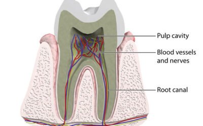 Root Canal Therapy to the Rescue!