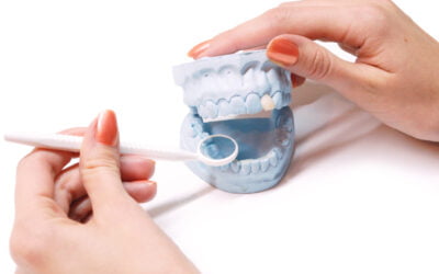 Crowns Protect Teeth