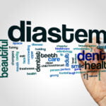 A word cloud featuring terms related to diastema, a dental condition. The largest words are "diastema," "beautiful," "dental," "healthy," "dentist," "care," "adult," and "happy." Other words include "chomp," "teeth," "smile," "periodontal," "hygiene," "health," "child," "cavity," "orthodontics," "checkup," "gum," "incisors," "mouth," "cheerful," "overcrowding," "disease," "medicine," "clean," "treatment," "funny," and many more, depicting a wide range of topics associated with dental health and aesthetics. A hand is seen holding a marker, indicating the creation of the word cloud.