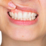 A close-up of a person's mouth with their upper lip lifted to show their teeth and gums. The teeth are clean and white, and the gums appear healthy and pink. The person's finger, with a neatly manicured nail, gently pulls up the lip. The image focuses on dental and gum health.