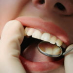 A close-up image of a dental examination. The patient’s mouth is open, revealing clean, white teeth. A dentist wearing latex gloves is using a dental mirror to inspect the teeth, focusing on the lower molars. The image captures the interaction between the dental tool and the patient's teeth, emphasizing oral hygiene and dental care.