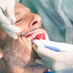 A close-up of a male patient with a beard receiving dental treatment. The dentist, wearing gloves, uses dental instruments to examine and clean the patient's teeth. The patient has his mouth open, and the dentist's hands and tools are clearly visible. The background is slightly blurred, focusing attention on the dental procedure.