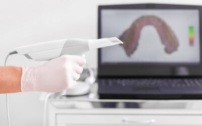 Invisalign – Let’s Do This!