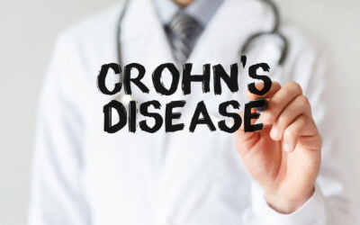 Maintain Oral Health Despite Crohn’s Disease