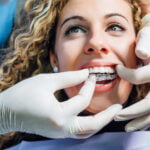 A close-up of a smiling young woman in a dental chair with curly blond hair, having her clear orthodontic aligners adjusted by a dental professional wearing blue scrubs and white gloves. The image captures a moment of dental care, emphasizing the aligners on the patient's teeth.